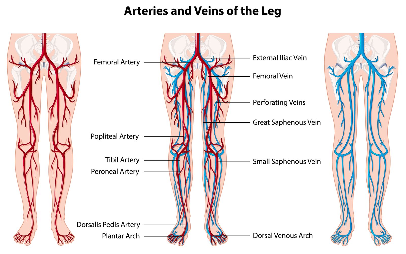Difference Between Direct and Indirect Hernia