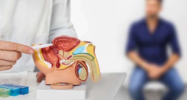 Does Hernia Affect Male Fertility