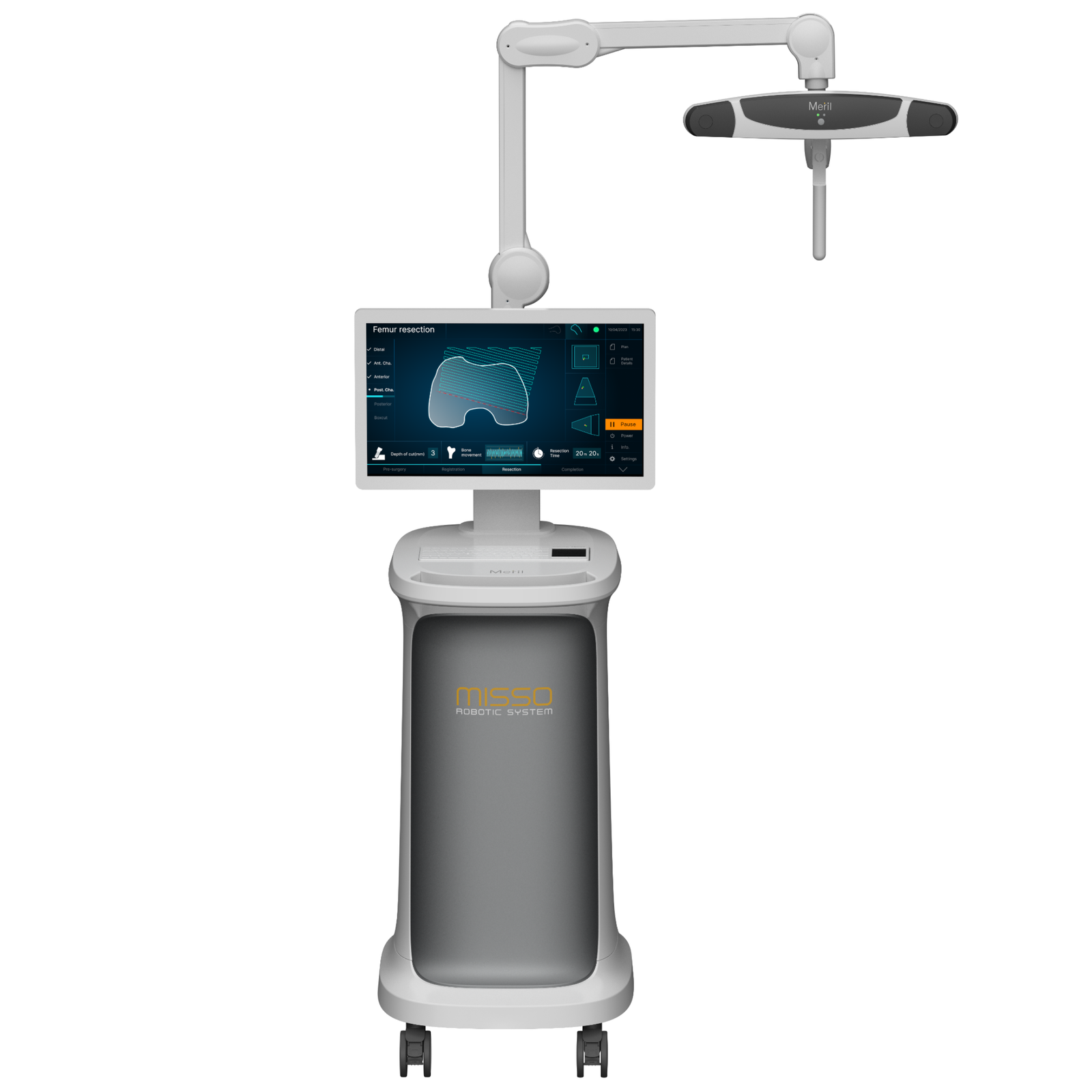 Robotic Knee Replacement Surgery