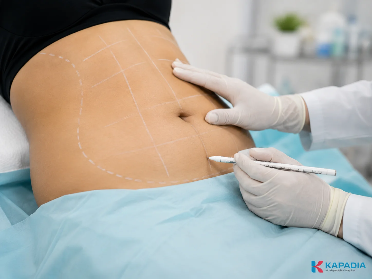 Body-contouring liposuction surgery in the operating theatre at Kapadia Hospital, Mumbai