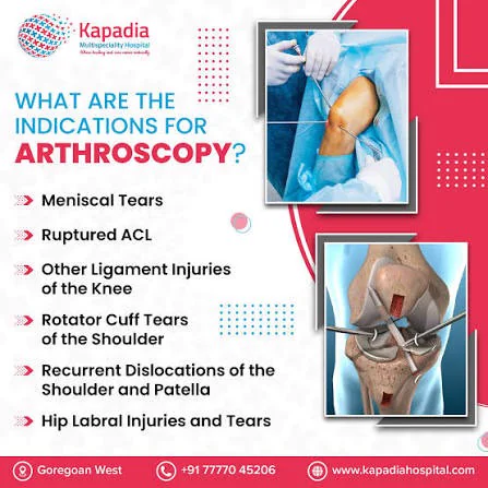 Arthroscopic keyhole surgery instruments in the operating theatre at Kapadia Hospital, Mumbai