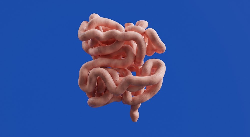 3D anatomy of the intestines illustrating anal fistula - Kapadia Hospital, Mumbai