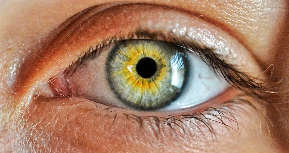 Close-up of the human eye examined for vision care at Kapadia Hospital, Mumbai